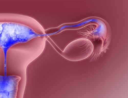 عکس رنگی رحم چیست؟ همه چیز درباره عکس رنگی رحم یا هیستروسالپنگوگرافی
