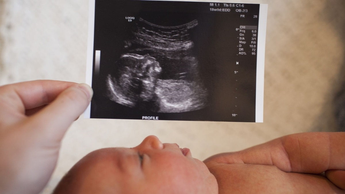 مشاهده جنین در سونوگرافی