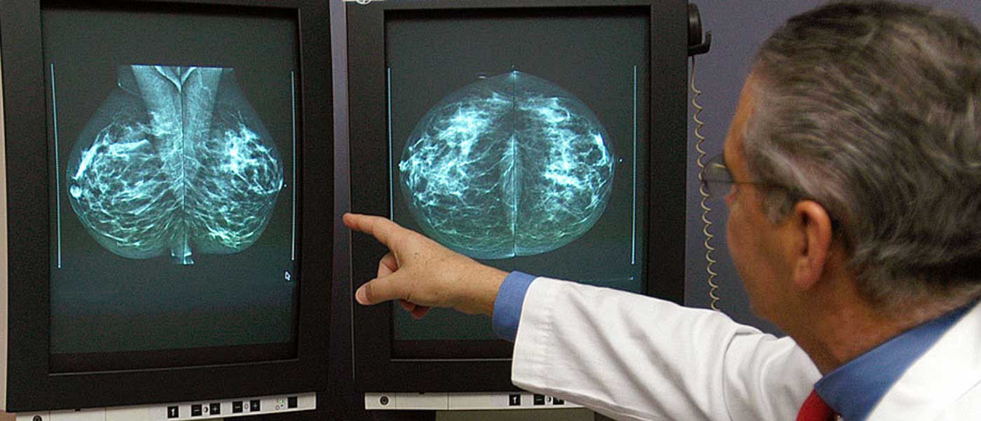 تصویربرداری سونوگرافی از پستان