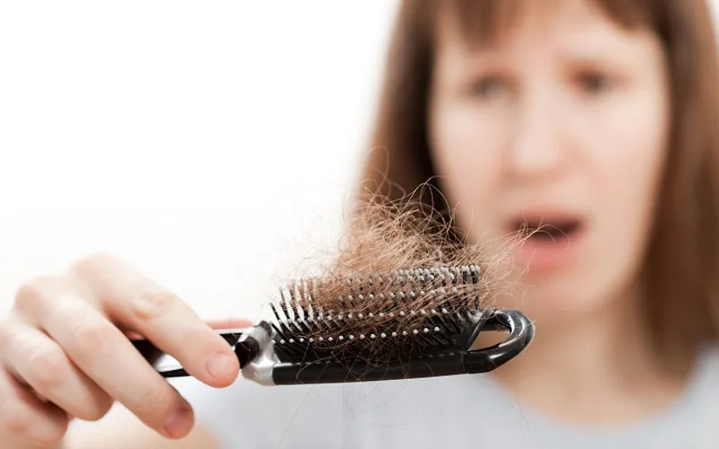 ریزش مو و کم کاری تیرویید