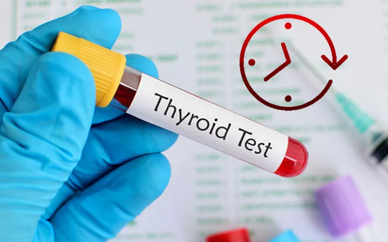 زمان اماده شدن جواب نمونه برداری از تیروئید