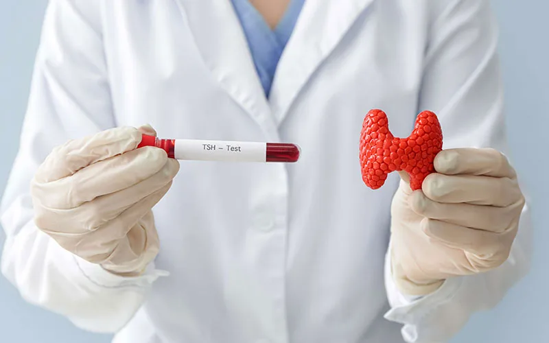 Thyroid test