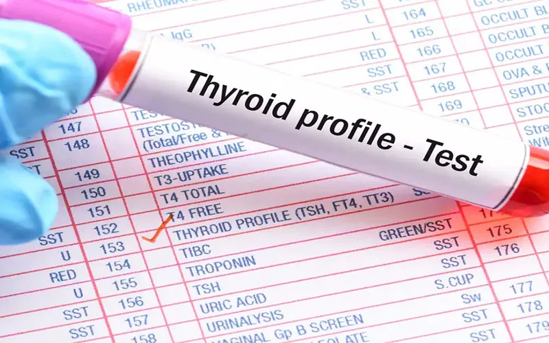 عدد tsh نرمال